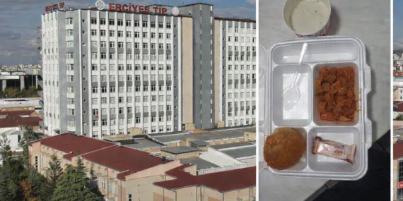 Nöbet Yorgunluğuna Bir de Açlık Eklendi: Erciyes Üniversitesi’nde Hemşireler Yetersiz Yemek Porsiyonlarına Tepkili